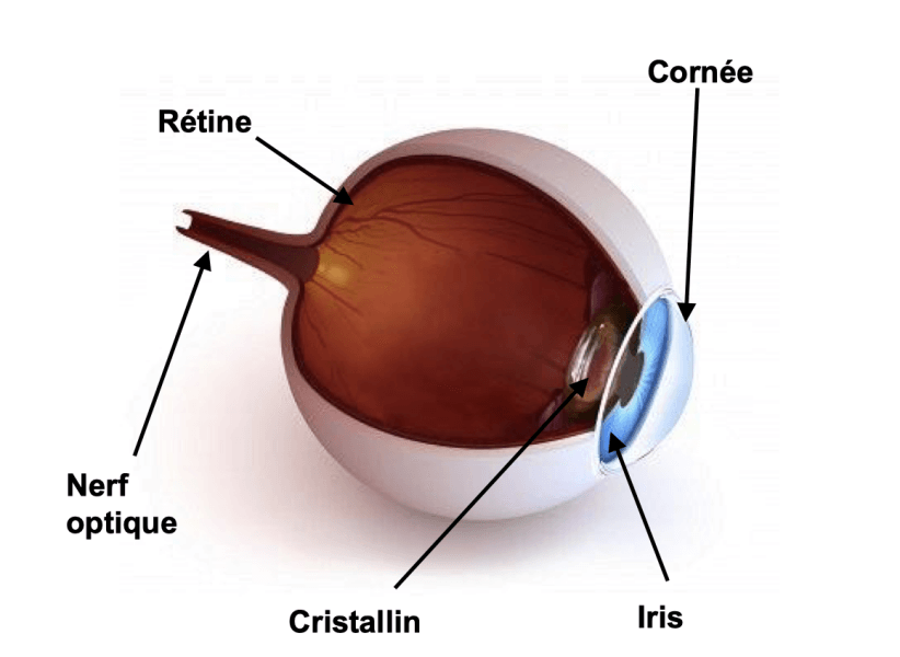 a quoi correspond la cataracte